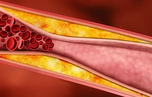 احرص على هذه الأطعمة لخفض مستوى الكوليسترول في رمضان