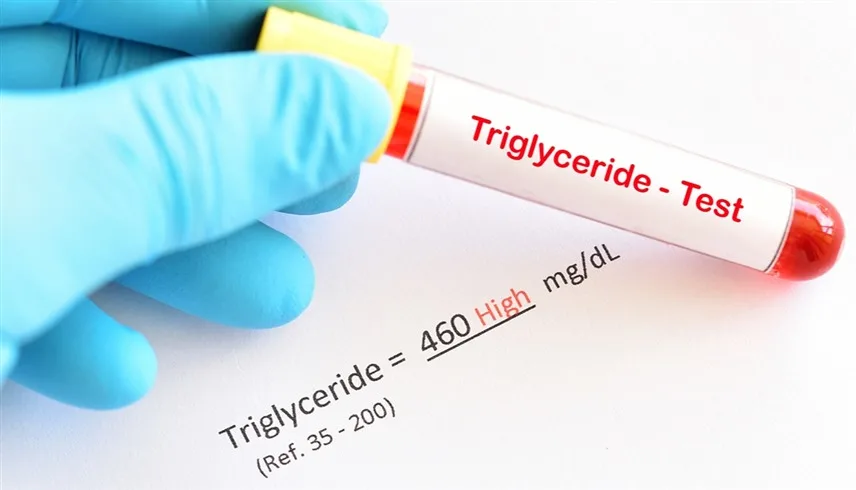 تحليل الدهون الثلاثية