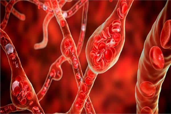 هذه الفاكهة تحافظ على سلامة الشرايين.. احرصي على تناولها