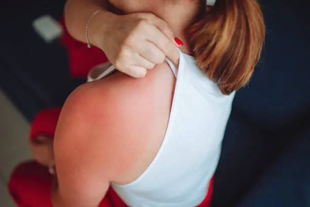 الطفح الجلدي