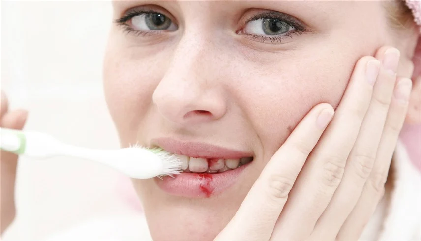 دواعم اللثة