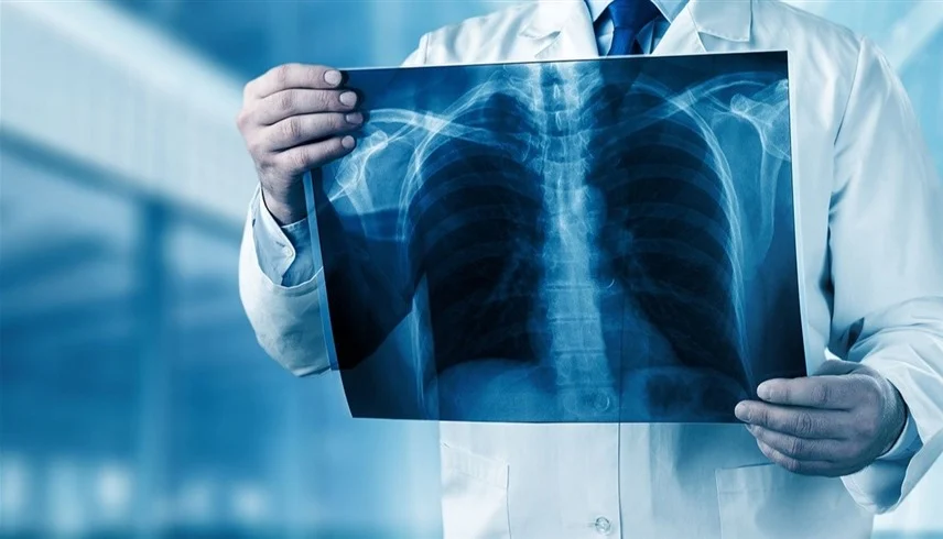 الاسترواح الصدري