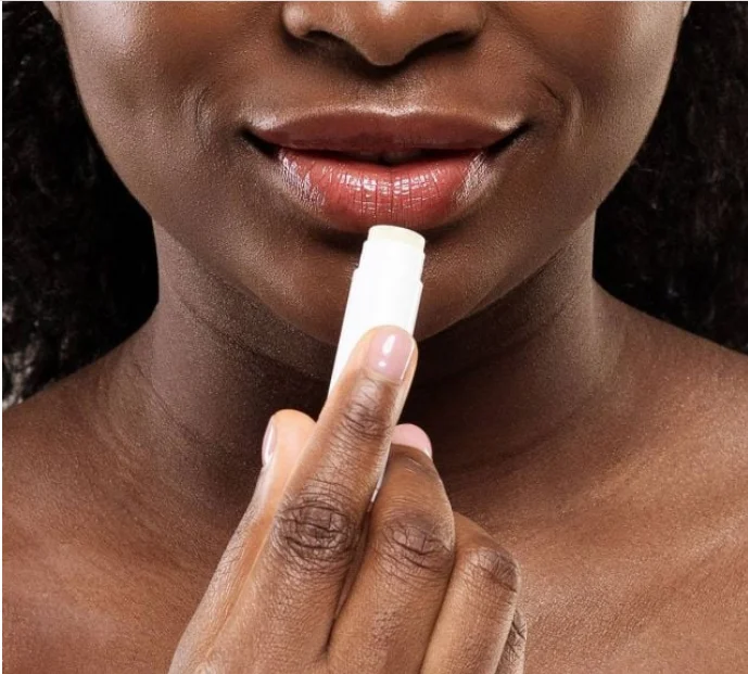 تشقق الشفاه