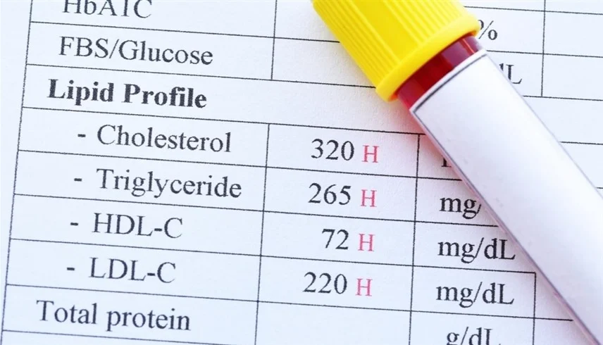 الكوليسترول