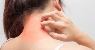 سرطان الجلد: العلامات التحذيرية التي يجب عدم تجاهلها وكيفية الوقاية