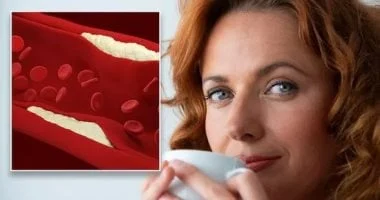 روشتة 2026: 4 طرق لخفض الكوليسترول الضار في العام الجديد 