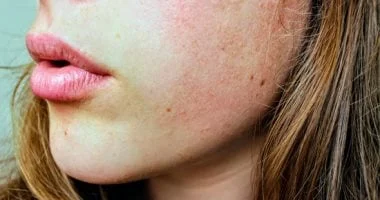 5 عادات خاطئة تسبب اتساع المسام تجنبيها واعتني ببشرتك 