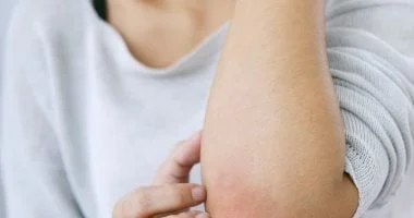 لماذا يتقشر الجلد رغم الترطيب؟ الأسباب وطرق العلاج 