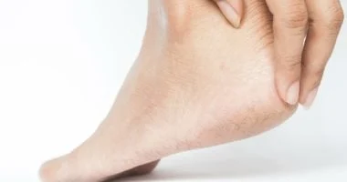 الكالو: علاجات طبيعية لتخفيف الألم وإزالة الجلد المتصلب 