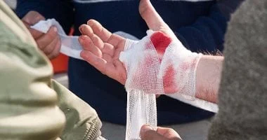 مسحوق قابل للرش يوقف النزيف الحاد خلال ثوانٍ 