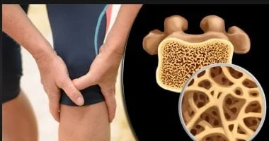 الكالسيوم مقابل فيتامين د: أيهما الأفضل لصحة العظام؟ 