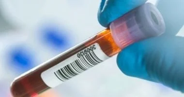 فحص دم بسيط يحدد أنسب علاج لسرطان الثدي 