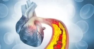 حمية لمدة يومين تخفض الكوليسترول وتساعد على إنقاص اثنين كيلوغرام 