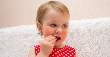 دليل بسيط لحماية طفلك من الحساسية الغذائية 