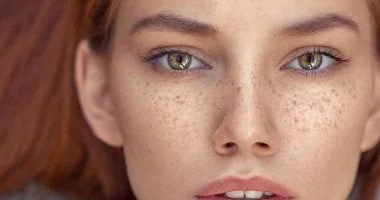 النمشات والبقع الدموية بالجلد: إشارات قد تكشف اضطراباً في الجسم 