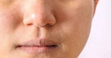 6 طرق سهلة وسريعة لترطيب البشرة والتخلص من الجفاف والجلد الميت 