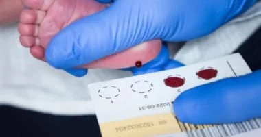 إسكتلندا تفحص حديثي الولادة للكشف المبكر عن ضمور العضلات الشوكية 